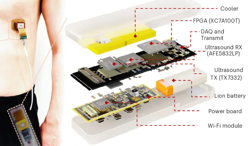 Parche por ultrasonido y terapia génica: alternativa al marcapasos