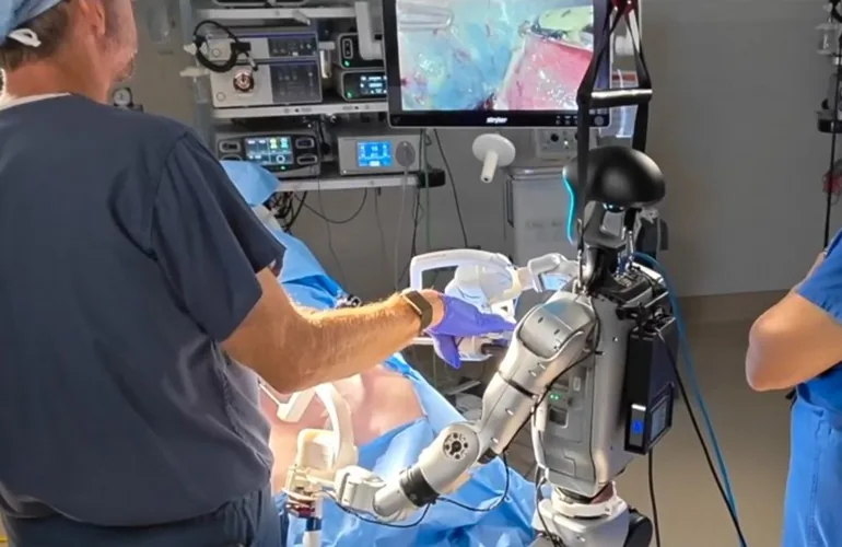 Robots humanoides operan por primera vez a un paciente