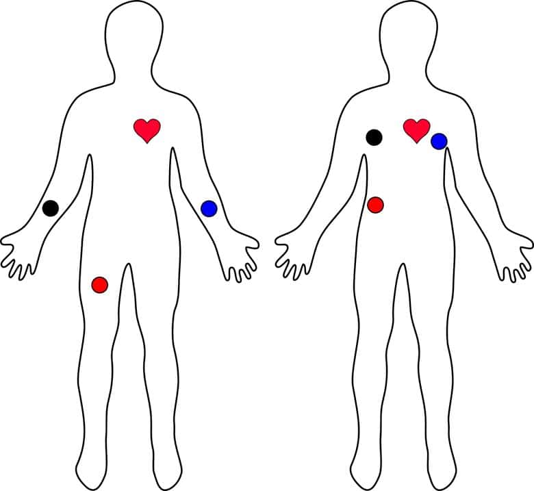 Ubicación de los tres electrodos en el cuerpo