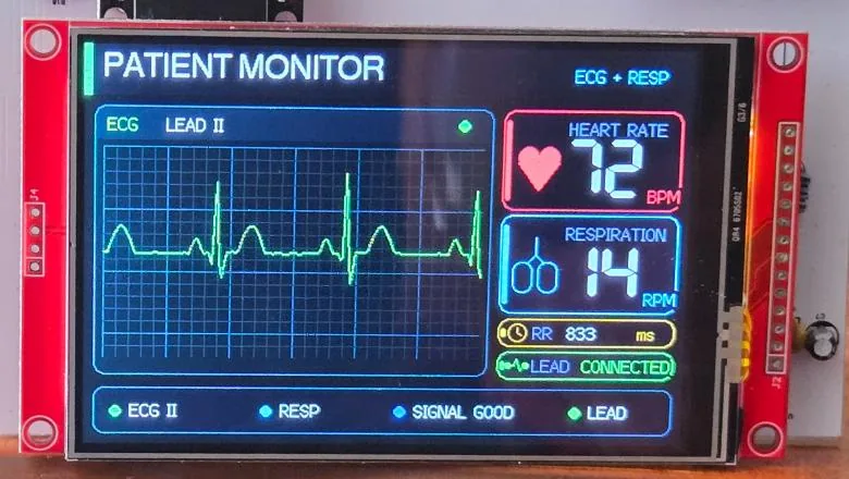 Monitor ECG con la curva y los valores en la pantalla TFT
